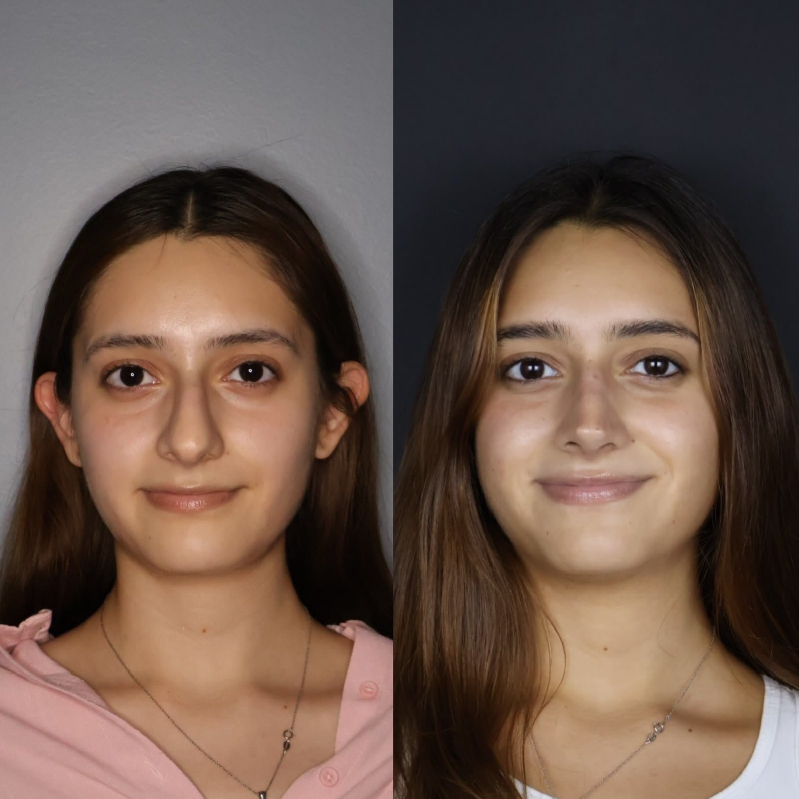 Resultado contorno corporal 1